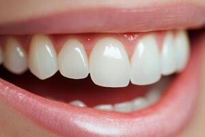 Bright smile showcasing healthy teeth in a close-up view highlighting oral care and dental hygiene photo