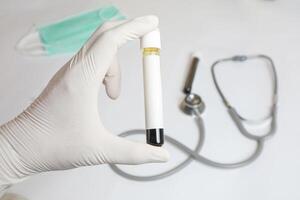 A person is holding a red blood test tube in a blue glove. Concept of caution and precision, as the person is handling a potentially hazardous substance. photo