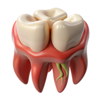 high-detail 3D render of a molar with perfect gum coverage, png