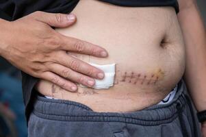 Cropped shot view of patient touching his belly after Appendectomy surgery. photo
