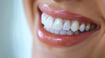 A person displays a bright smile featuring well maintained and white teeth. The cheerful expression indicates pride in dental hygiene and care. The background is softly blurred to emphasize the smile. photo