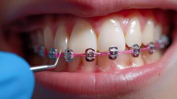 An orthodontist performs an adjustment on a patient's braces, focusing on proper alignment and dental health. The clinic is well lit, creating a clean and professional environment. photo