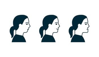 Bite normal jaw and malocclusion, face woman in profile set. Dental problem. Wrong bite, lower jaw extended forward and retracted. Bite correction. illustration vector