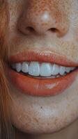 A close up of a woman's teeth with freckles photo