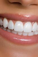 Close up of a perfect smile with glossy lips and white teeth photo