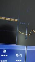 Heart cardiogram and numbers on screen. Yellow line moves at certain heart rate on black screen. Motion of wavy line of cardiogram on monitor. Close-up. Vertical video