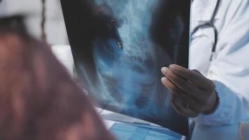A doctor is looking at a x - ray image of a patient video