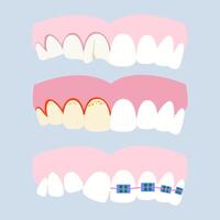 Various dental problems and diseases. Oral problems, caries, tartar, plaque, orthodontic braces, various injuries. illustration vector