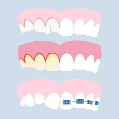 Various dental problems and diseases. Oral problems, caries, tartar, plaque, orthodontic braces, various injuries. illustration