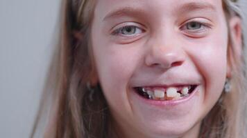 Smiling little girl showing metallic teeth and making funny face video