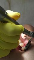 Doctor working with instruments in patient's open mouth for dental treatment video