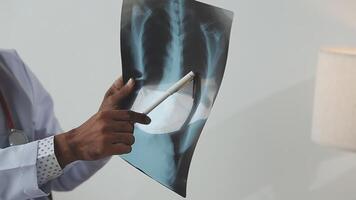 A doctor holding a x - ray image in front of him video