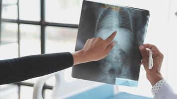 A doctor is pointing at an x - ray image of a patient video