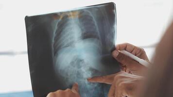 A person is holding a x - ray image on a clipboard video
