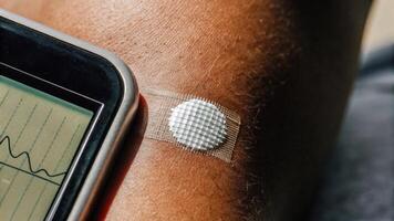 Macro shot of a skin patch equipped with microneedles extracting data with the skins texture visibly interacting with a digital device showing health progression graphs.. photo