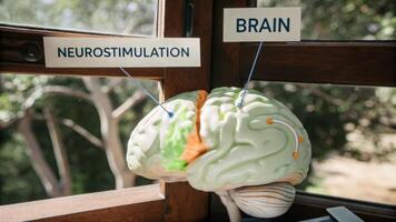 An infographicstyle image depicting the layers of the brain with annotated areas where neurostimulation is applied showcasing potential therapeutic benefits.. photo
