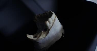 The orthodontist adds parts of the cast of the jaw by assembling the jaw structure on a plaster backing. Dental prosthetics, work on the creation of prostheses. in 4k, red komodo video