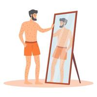 Sad man standing in front of a mirror with red spots on his body. Man character suffers from rash. cartoon illustration. vector