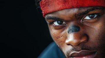 A close up of a man with a black eye photo