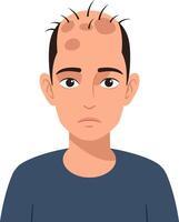 A sad young man with thinning hair and a blue shirt in a minimal flat design illustration expressing concern and vulnerability in a simple style vector