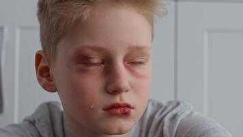 A young child with disheveled hair is visibly upset, resting their head on a surface in a dimly lit room. Signs of emotional turmoil suggest a difficult home environment characterized by tension. video