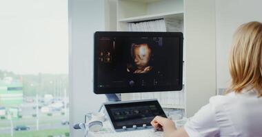 ein Ultraschall Arzt sieht aus beim ein 3d Bild von das Fötus auf das Monitor von ein Ultraschall Maschine im ein modern Klinik. Dirigieren Ultraschall Diagnose von fötal Entwicklung. im 4k, rot komodo video