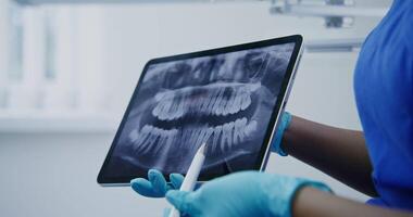 Woman dentist of African American appearance shows the patient a picture of the teeth using a tablet and talks about the condition of the teeth, close-up video