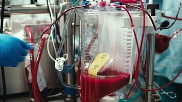 Blood circulation machine in the operating room used during heart surgery. Innovative medical technologies ensuring life support and successful heart surgeries. video