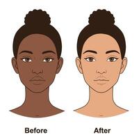 Before and after photo of a woman's face before and after makeup vector