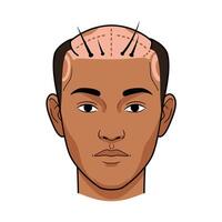 A man with a shaved head and a bald spot vector