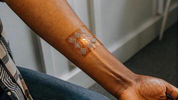 A detailed shot of skin patch biosensors applied to forearm skin carefully monitoring glucose levels in realtime illustrating the intersection of wearable technology and AI for. photo