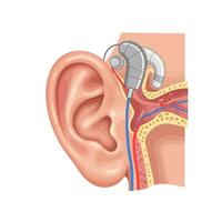 An ear with a hearing aid and a microphone vector