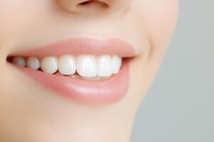 Close up of a perfect smile, showing white teeth and healthy lips against a neutral background photo