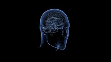 X-ray style visualization of the head and brain. video
