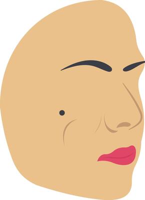 Birthmark illustration with isolated background