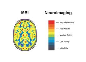 MRI scan of the brain. Magnetic resonance imaging, a medical imaging technique in radiology, depicts anatomical and physiological processes in the mind. vector