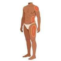 A Diverse Race Male With Marked Areas for Liposuction vector