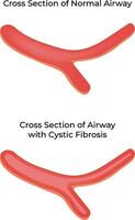 Cross Section of Normal Airway Science Design Illustration Diagram vector