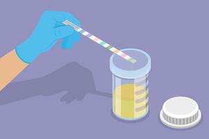 3D Isometric Flat Conceptual Illustration of Urine Analysis, Lab Test vector