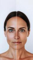 Close-up comparison of a woman's face before and after facial massage and skincare treatment, showing reduced swelling and smoother complexion. Visible rejuvenation effects. . photo