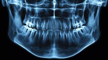 X-ray image of human jaw and teeth showing dental structures photo