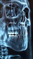 Detailed x-ray illustration of human skull showing teeth and jaw structure photo