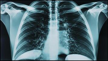 Chest X-ray visualizing internal organs and skeletal structures. Provides essential information for medical assessment and diagnosis. photo