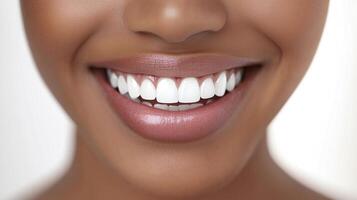 Close-up of a beautiful smile featuring perfectly aligned, bright white teeth and glossy lips against a blurred backdrop, ideal for dental health. photo