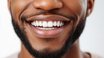 A close-up of a smiling man with a beard and perfectly aligned white teeth, radiating confidence and health, showcasing dental aesthetics. photo
