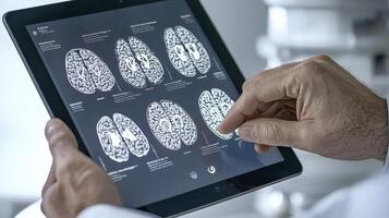 Analyzing Brain Scans A detailed look at medical imagery showcasing diagnostic tools and advanced neurology Explore the complexities of the human brain with clear and precise scans Investigate photo