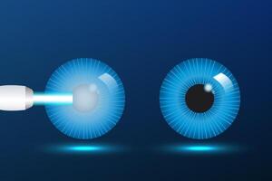 Glaucoma poster. Increased intraocular pressure, optic nerve damage, and vision loss. Blurred vision, deterioration of vision vector