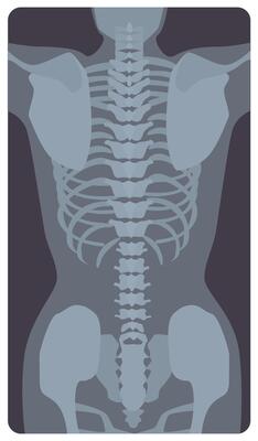 Anterior radiograph of human rib cage and pelvis. X-ray picture or radiographic image of bones and joints, front view. Medical diagnostics. Monochrome illustration in flat cartoon style