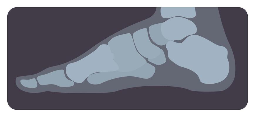 Lateral radiograph of human foot or limb. X-ray picture or radiographic image of metatarsus bones and toes, side view. Modern medical radiography. Monochrome illustration in flat cartoon style