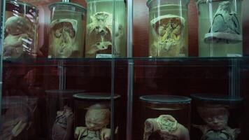 Human in formalin in medical museum. Collection of human organs preserved in large jars with formaldehyde and displayed vertically in museum video